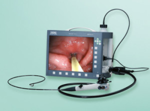 Endoscope - Video endoscope